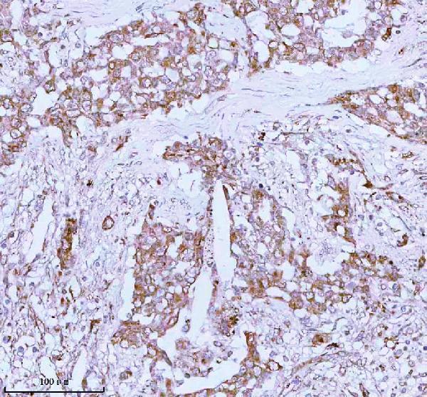  IHC analysis of ME3 using anti-ME3 antibody (A05164-2)
