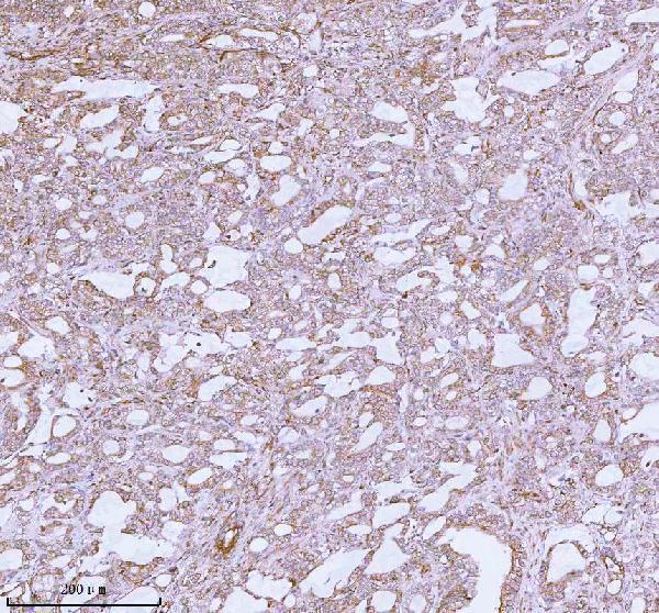 a05164 2 me3 primary antibodies ihc testing 6