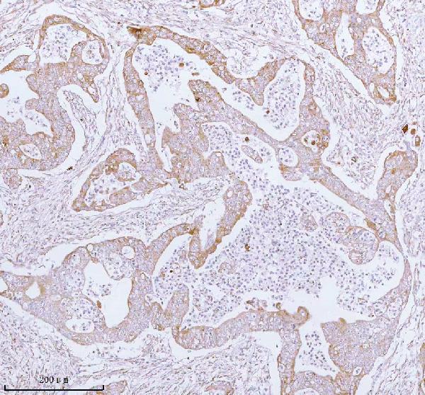 a05164 2 me3 primary antibodies ihc testing 8