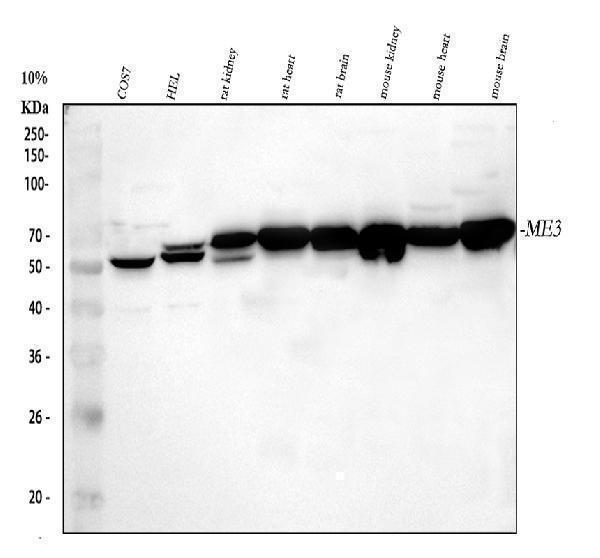 Western blot analysis of ME3 using anti-ME3 antibody (A05164-2)