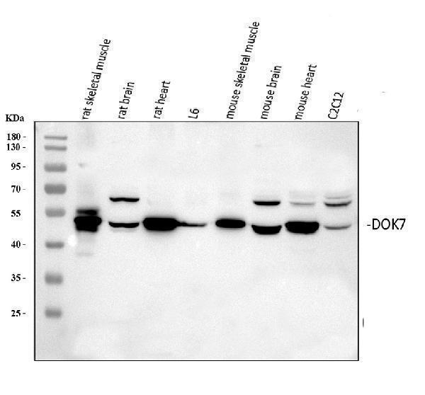 a05165 1 dok7 primary antibodies wb testing 2