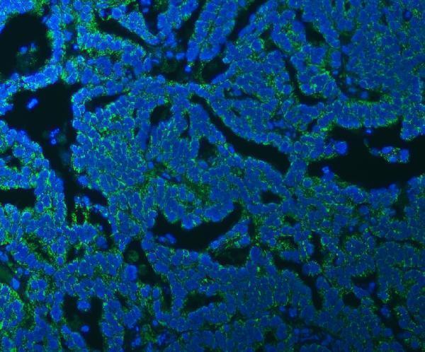 a05166 1 ssbp1 primary antibodies if testing 7