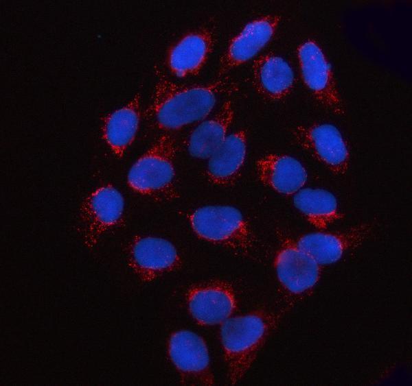 a05166 1 ssbp1 primary antibodies if testing 8