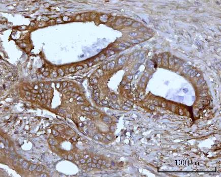  IHC analysis of SSBP1 using anti-SSBP1 antibody (A05166-1)