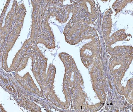  IHC analysis of SSBP1 using anti-SSBP1 antibody (A05166-1)
