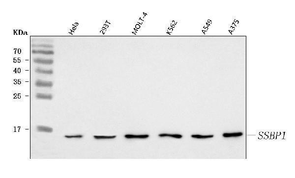  Western blot analysis of SSBP1 using anti-SSBP1 ntibody (A05166-1)