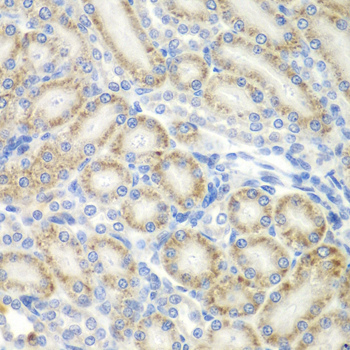 a05168 2 aspscr1 primary antiboties ihc testing 2