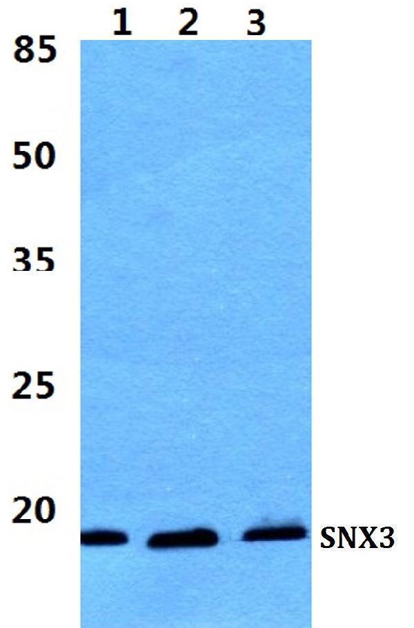 Western blot (WB) analysis of SNX3 polyclonal antibody at 1:500 dilution
Lane1:MCF-7 cell lysate
Lane2:Raw264