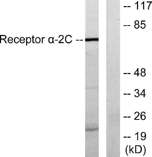 a05170 adra2c primary antibodies wb testing 3
