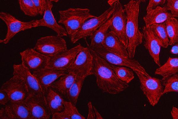 a05171 3 mmp19 primary antibodies if testing 5
