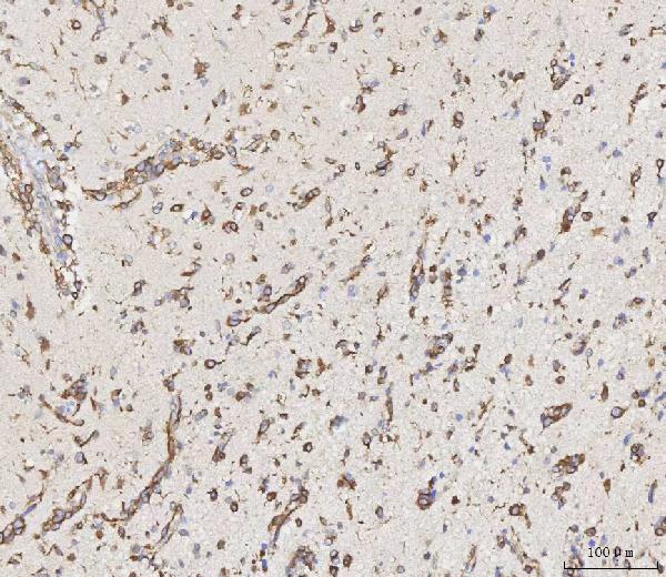  IHC analysis of MMP19 using anti-MMP19 antibody (A05171-3)