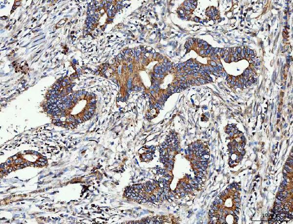  IHC analysis of MMP19 using anti-MMP19 antibody (A05171-3)