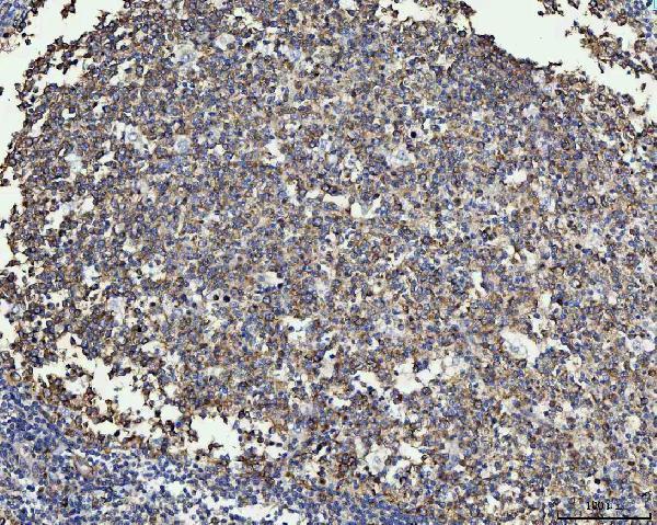 a05171 3 mmp19 primary antibodies ihc testing 4