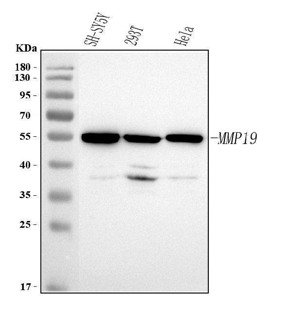  Western blot analysis of MMP19 using anti-MMP19 antibody (A05171-3)