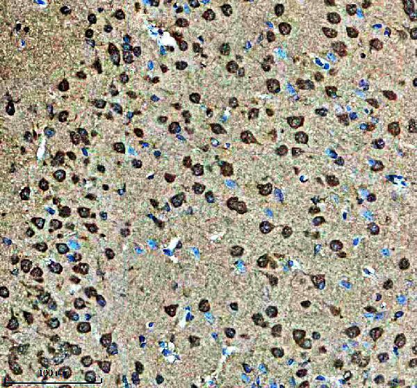 a05172 1 cdk14 primary antibodies ihc testing 1
