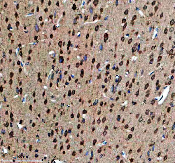 a05172 1 cdk14 primary antibodies ihc testing 2