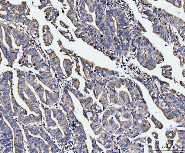  IHC analysis of EDC4 using anti-EDC4 antibody (A05173-2)