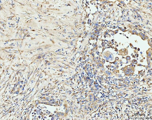  IHC analysis of EDC4 using anti-EDC4 antibody (A05173-2)