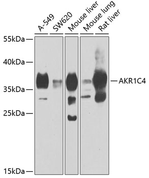 a05174 akr1c4 primary antiboties wb testing 1