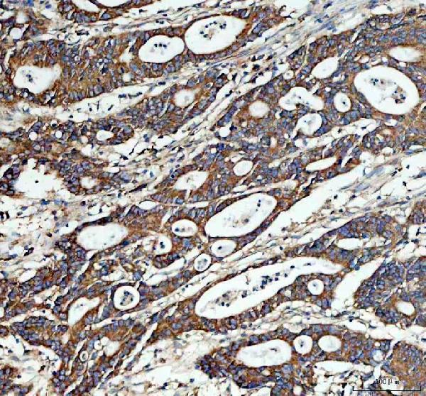 IHC analysis of Ribosomal protein L4/RPL4 using anti-Ribosomal protein L4/RPL4 antibody (A05175-1)