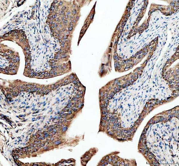  IHC analysis of Ribosomal protein L4/RPL4 using anti-Ribosomal protein L4/RPL4 antibody (A05175-1)