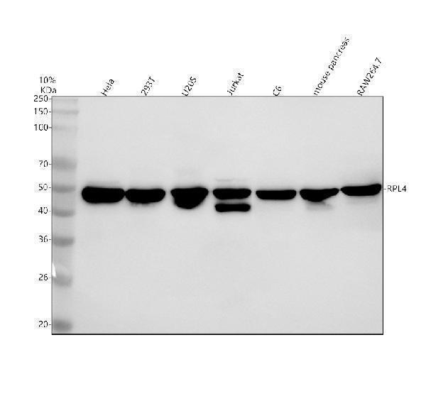  Western blot analysis of Ribosomal protein L4/RPL4 using anti-Ribosomal protein L4/RPL4 antibody (A05175-1)