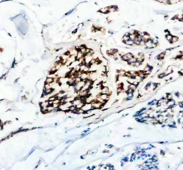 IHC analysis of CAPRIN1 using anti-CAPRIN1 antibody (A05178-2)