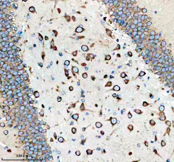 a05178 2 caprin1 primary antibodies ihc testing 10
