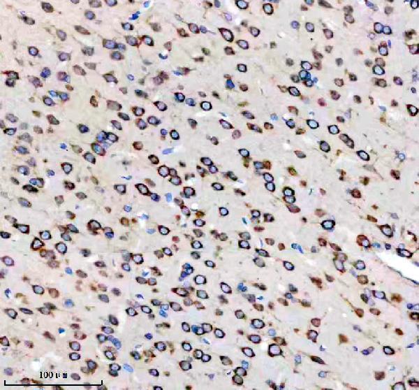 a05178 2 caprin1 primary antibodies ihc testing 11