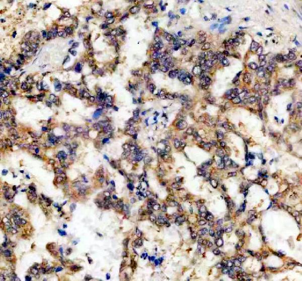 IHC analysis of CAPRIN1 using anti-CAPRIN1 antibody (A05178-2)