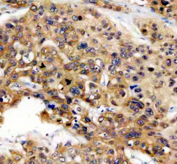 IHC analysis of CAPRIN1 using anti-CAPRIN1 antibody (A05178-2)