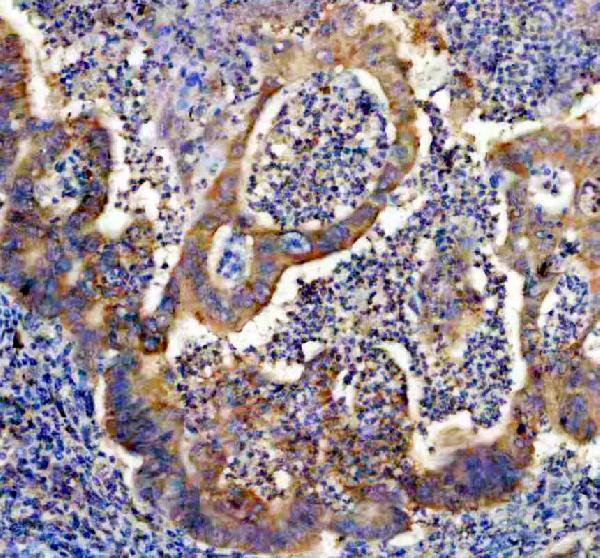 a05178 2 caprin1 primary antibodies ihc testing 4