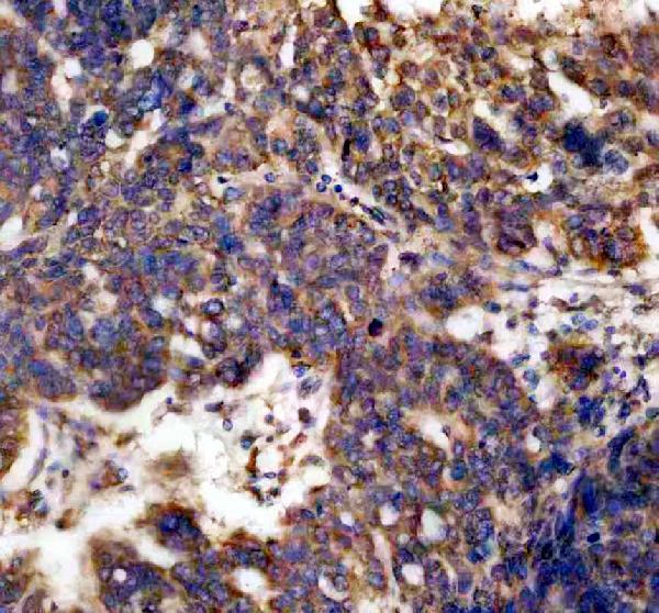 a05178 2 caprin1 primary antibodies ihc testing 5