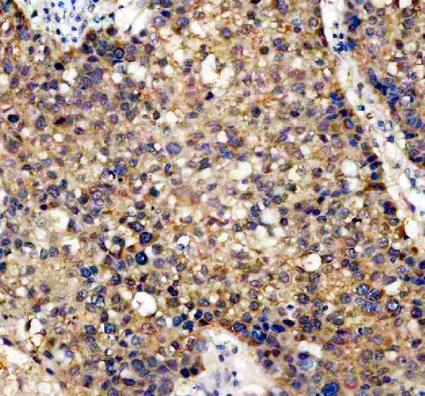 a05178 2 caprin1 primary antibodies ihc testing 6