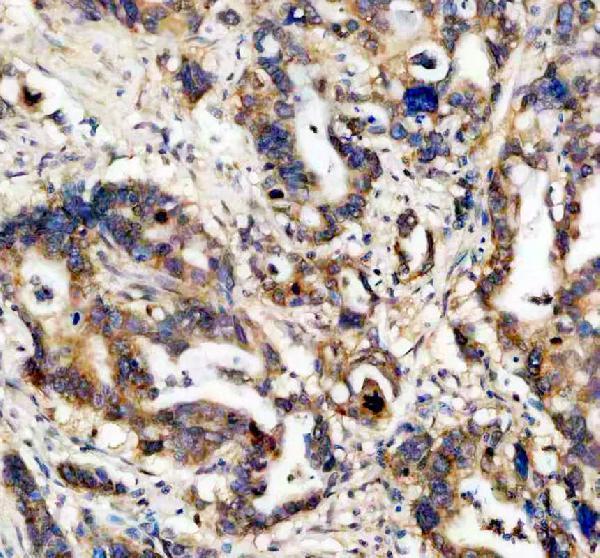 a05178 2 caprin1 primary antibodies ihc testing 7