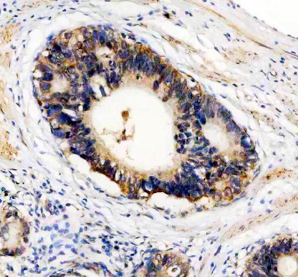 a05178 2 caprin1 primary antibodies ihc testing 8