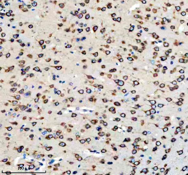 a05178 2 caprin1 primary antibodies ihc testing 9