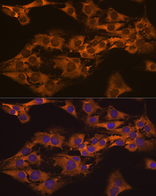 Immunofluorescence analysis of C6 cells using CAPRIN1 Rabbit pAb  at dilution of 1:100 