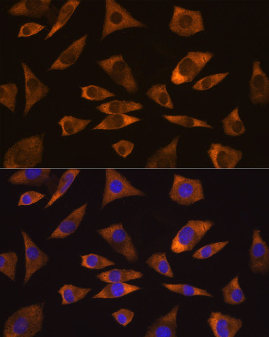 Immunofluorescence analysis of L929 cells using CAPRIN1 Rabbit pAb  at dilution of 1:100 