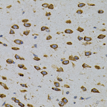 a05178 caprin1 primary antiboties wb testing 2