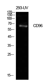 Western blotting validation for Anti-T-cell surface protein tactile CD96 Antibody A05179
Western Blot (WB) analysis of 293-UV cells using CD96 polyclonal antibody