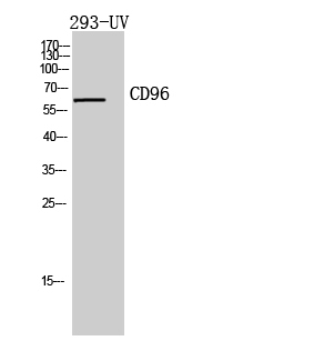Western blotting validation for Anti-T-cell surface protein tactile CD96 Antibody A05179
Western Blot (WB) analysis of 293-UV cells using CD96 polyclonal antibody