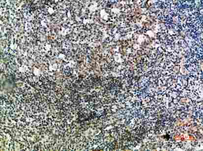 Immunohistochemical analysis of paraffin-embedded human-tonsil, antibody was diluted at 1:200