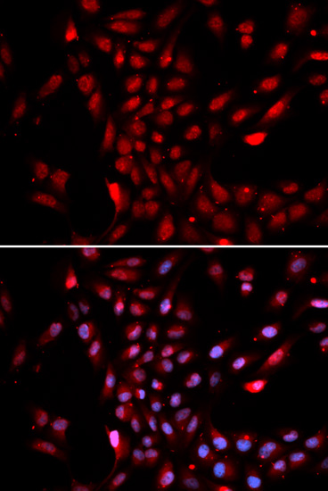 a05188 1 kpna4 primary antiboties ihc testing 3