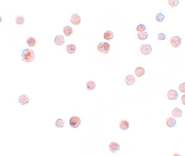 Immunocytochemistry of KPNA4 in HeLa cells with KPNA4 antibody at 2