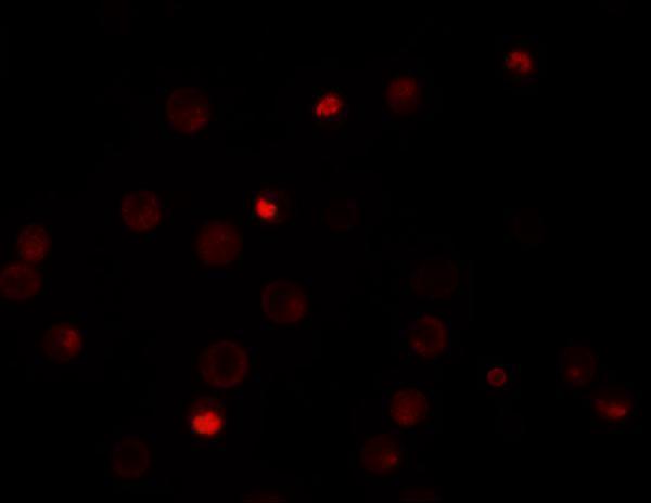 Immunofluorescence of KPNA4 in HeLa cells with KPNA4 antibody at 20 μg/mL
