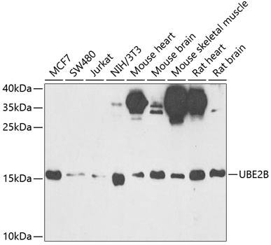 Western blot analysis of extracts of various cell lines, using UBE2B antibody  at 1:1000 dilution