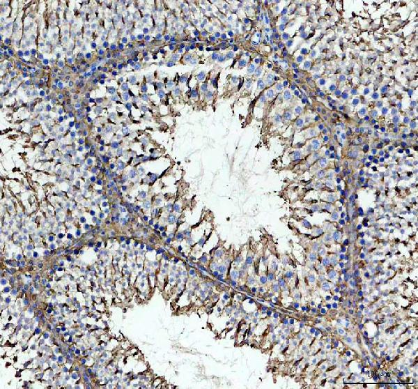 IHC analysis of ULBP3 using anti-ULBP3 antibody (A05191-1)
