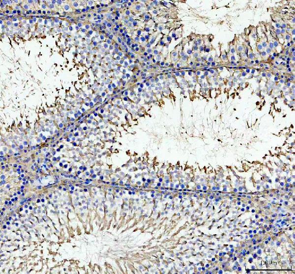 IHC analysis of ULBP3 using anti-ULBP3 antibody (A05191-1)