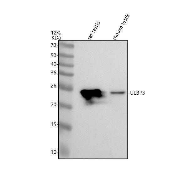 Western blot analysis of ULBP3 using anti-ULBP3 antibody (A05191-1)